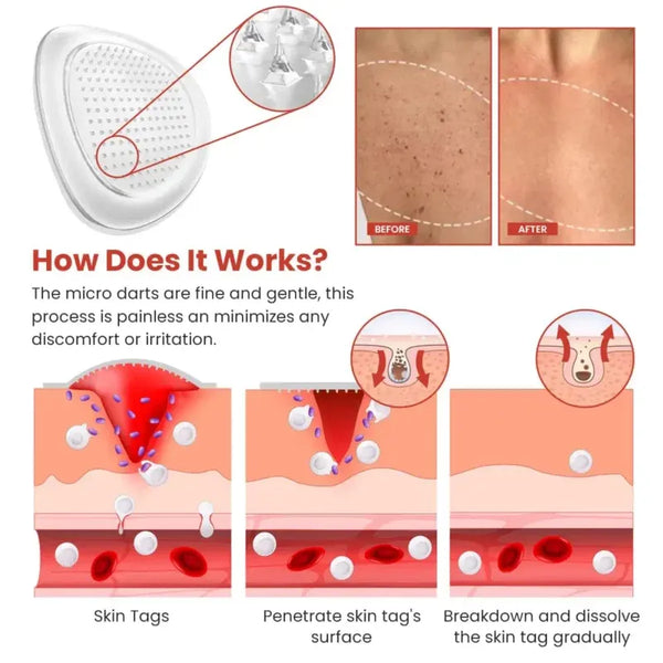 DERMA SMOOTH TAG REMOVER
